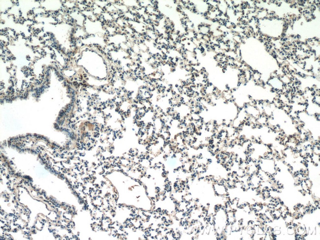 F2RL3 Antibody in Immunohistochemistry (Paraffin) (IHC (P))