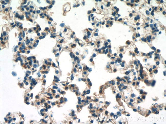 F2RL3 Antibody in Immunohistochemistry (Paraffin) (IHC (P))