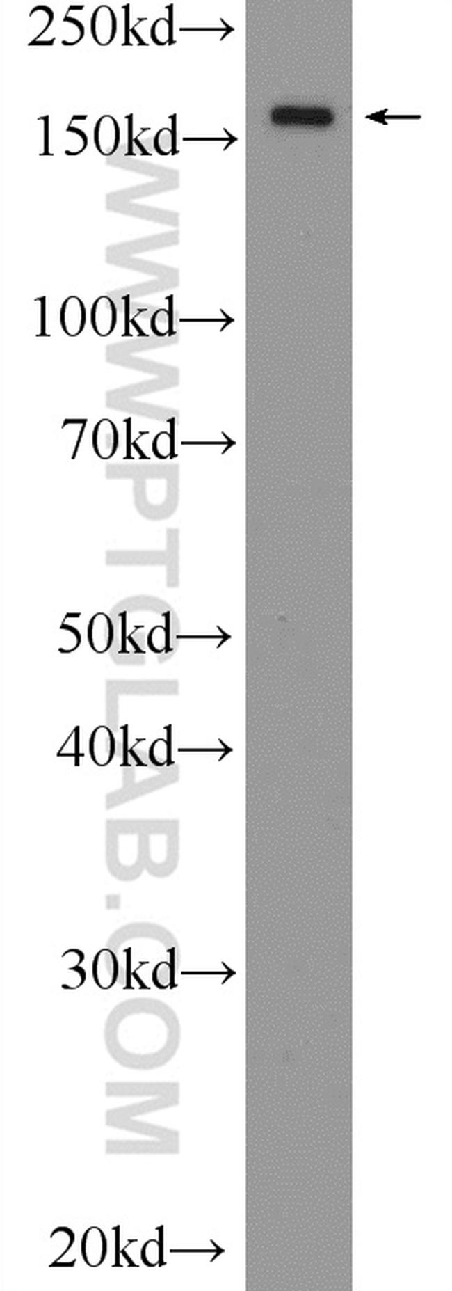 EPRS Antibody in Western Blot (WB)