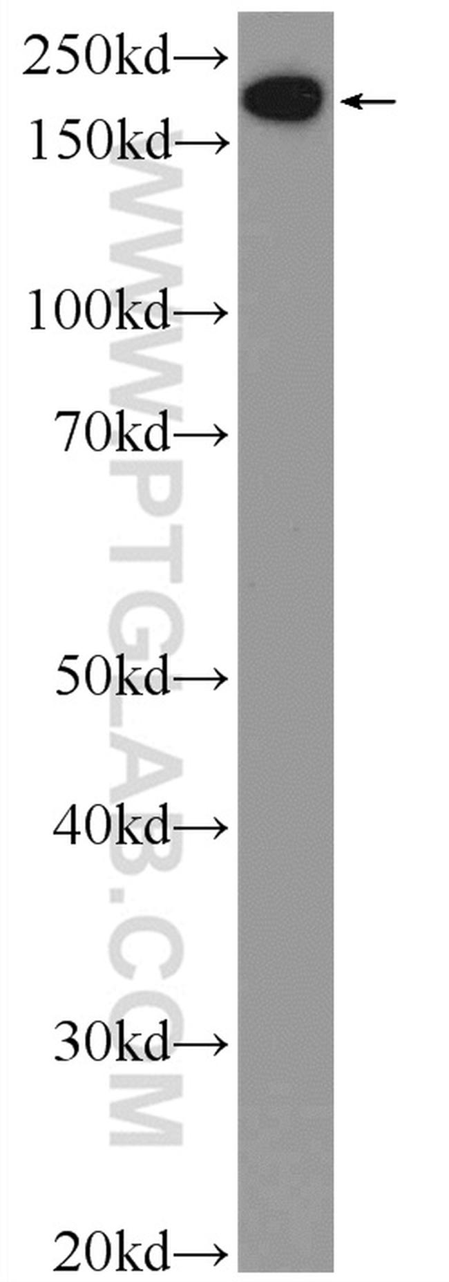 EPRS Antibody in Western Blot (WB)