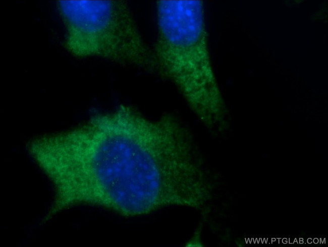 FGF17 Antibody in Immunocytochemistry (ICC/IF)