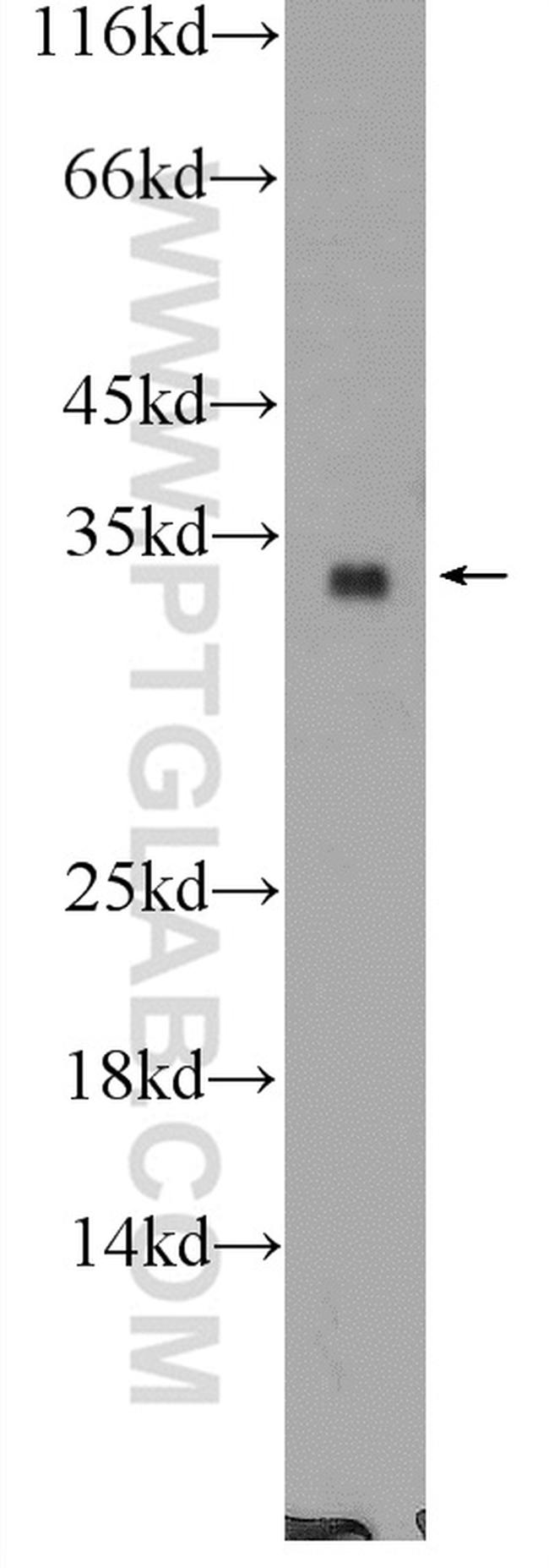 FGF17 Antibody in Western Blot (WB)