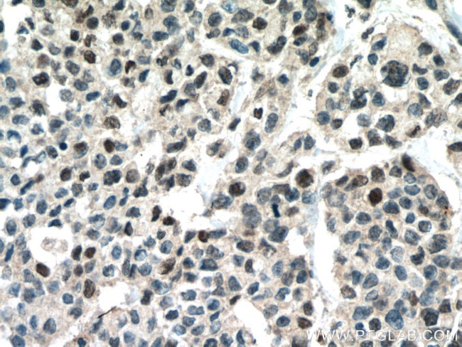 RUNX1 (middle) Antibody in Immunohistochemistry (Paraffin) (IHC (P))