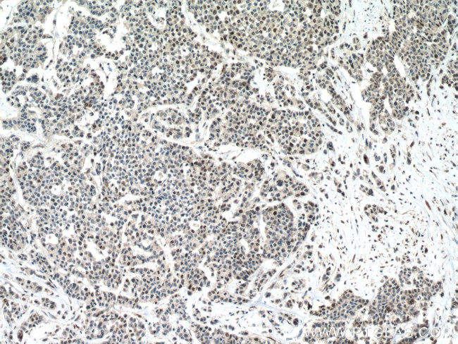 RUNX1 (middle) Antibody in Immunohistochemistry (Paraffin) (IHC (P))