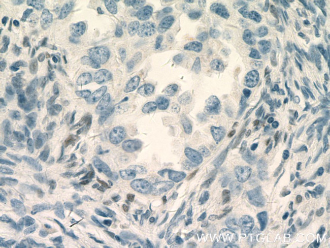 RUNX1 (middle) Antibody in Immunohistochemistry (Paraffin) (IHC (P))