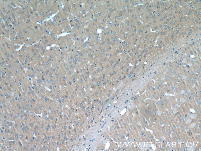 ATP6V1G2 Antibody in Immunohistochemistry (Paraffin) (IHC (P))