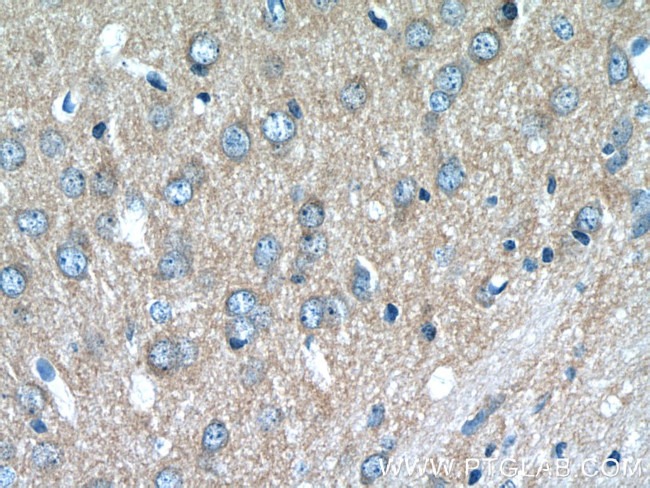 ATP6V1G2 Antibody in Immunohistochemistry (Paraffin) (IHC (P))