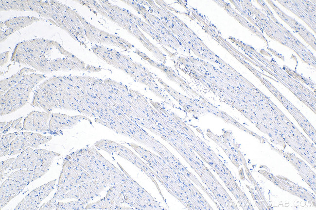 Desmoplakin Antibody in Immunohistochemistry (Paraffin) (IHC (P))