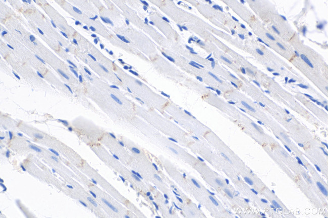 Desmoplakin Antibody in Immunohistochemistry (Paraffin) (IHC (P))