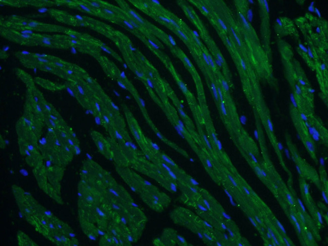 Desmoplakin Antibody in Immunohistochemistry (PFA fixed) (IHC (PFA))