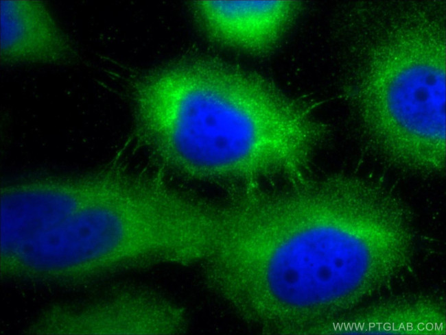 Desmoplakin Antibody in Immunocytochemistry (ICC/IF)