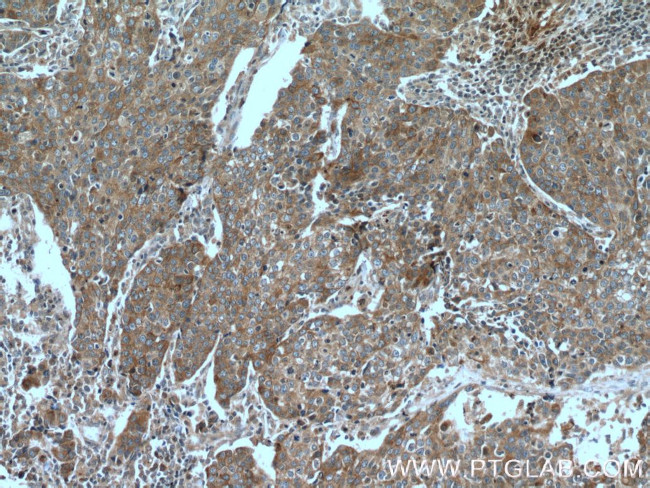 Desmoplakin Antibody in Immunohistochemistry (Paraffin) (IHC (P))