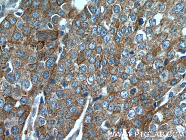 Desmoplakin Antibody in Immunohistochemistry (Paraffin) (IHC (P))