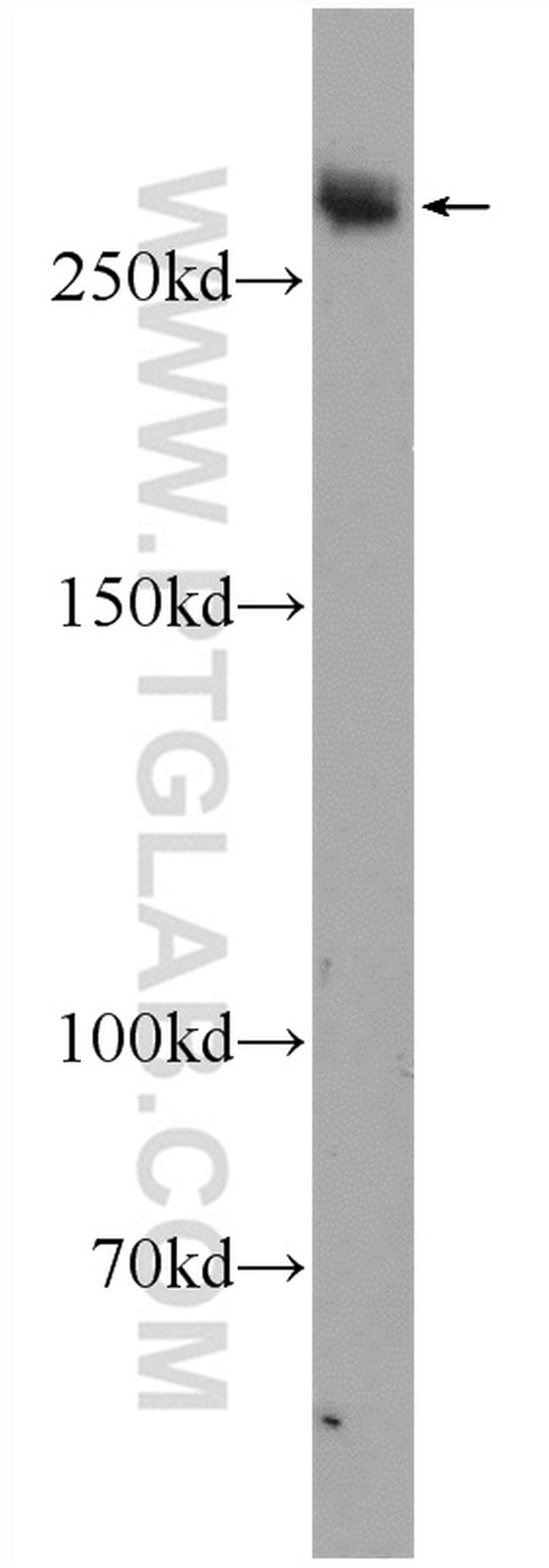 Desmoplakin Antibody in Western Blot (WB)