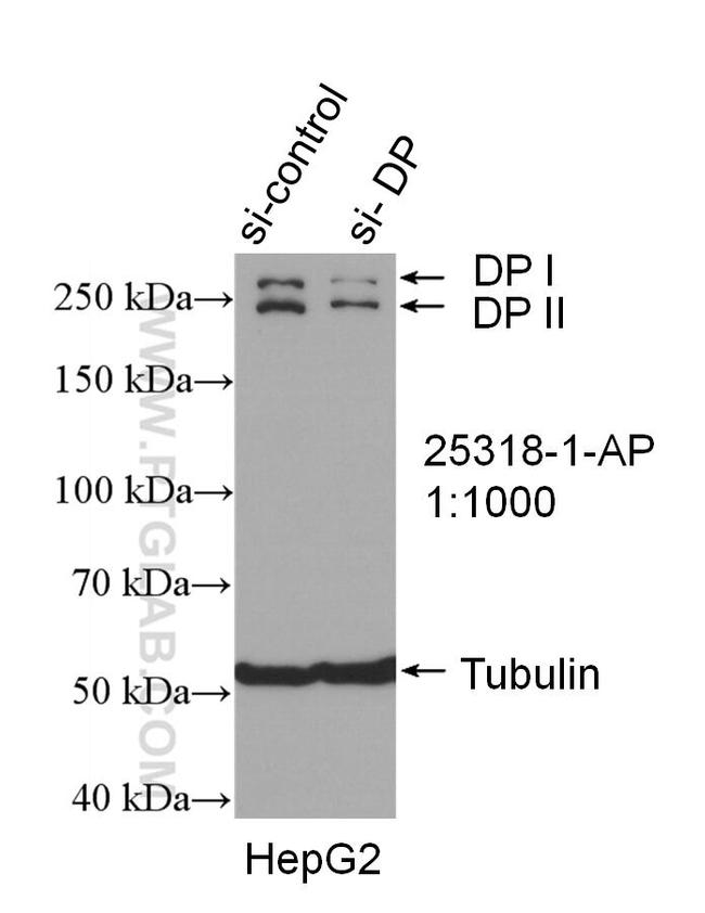 Desmoplakin Antibody in Western Blot (WB)