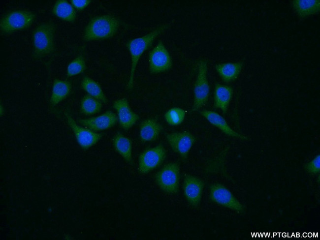 DYNC1LI1 Antibody in Immunocytochemistry (ICC/IF)