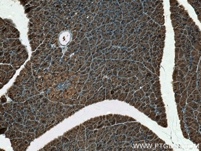 DYNC1LI1 Antibody in Immunohistochemistry (Paraffin) (IHC (P))