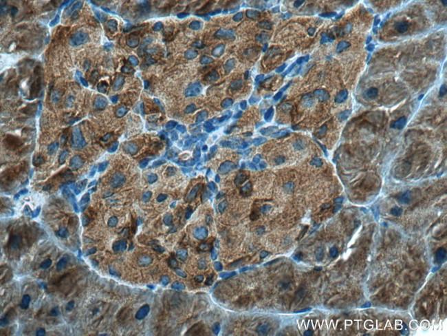 DYNC1LI1 Antibody in Immunohistochemistry (Paraffin) (IHC (P))