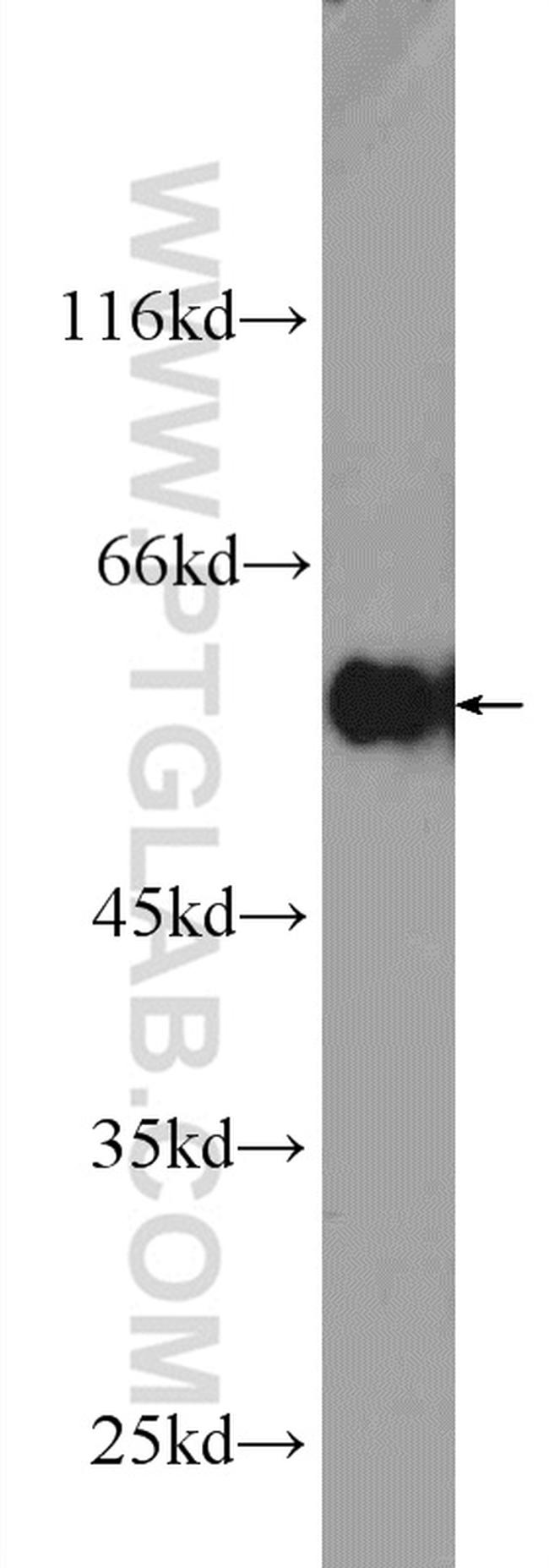 DYNC1LI1 Antibody in Western Blot (WB)