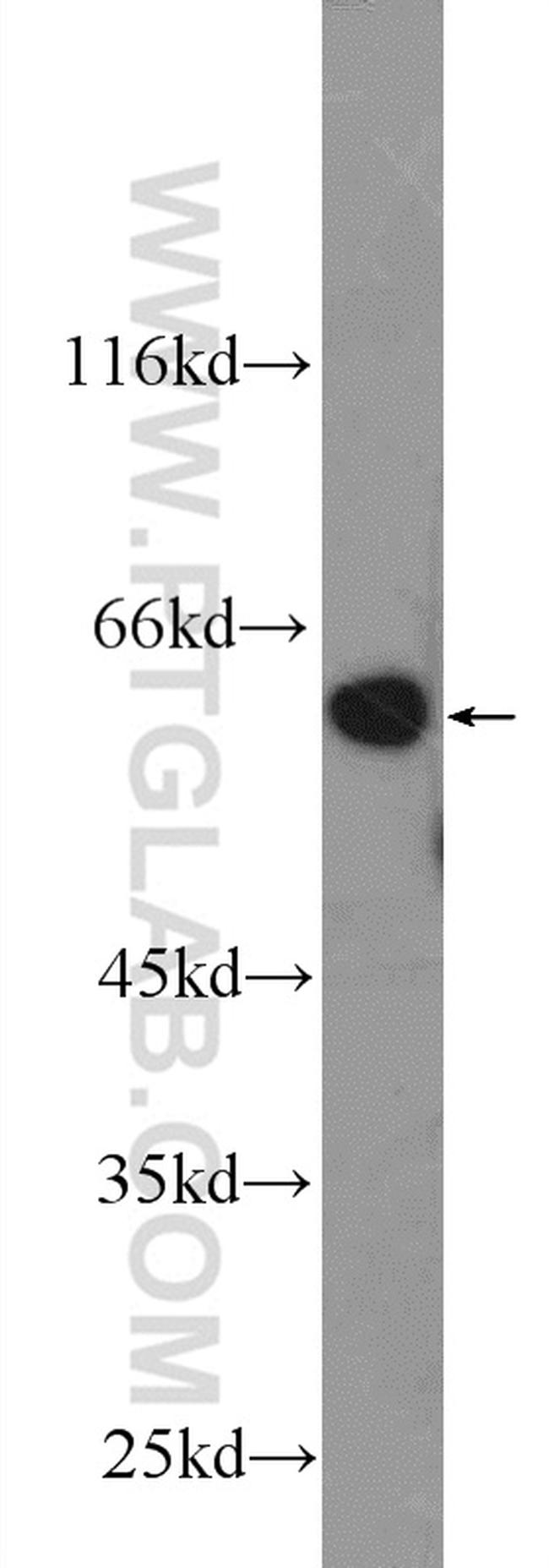 DYNC1LI1 Antibody in Western Blot (WB)