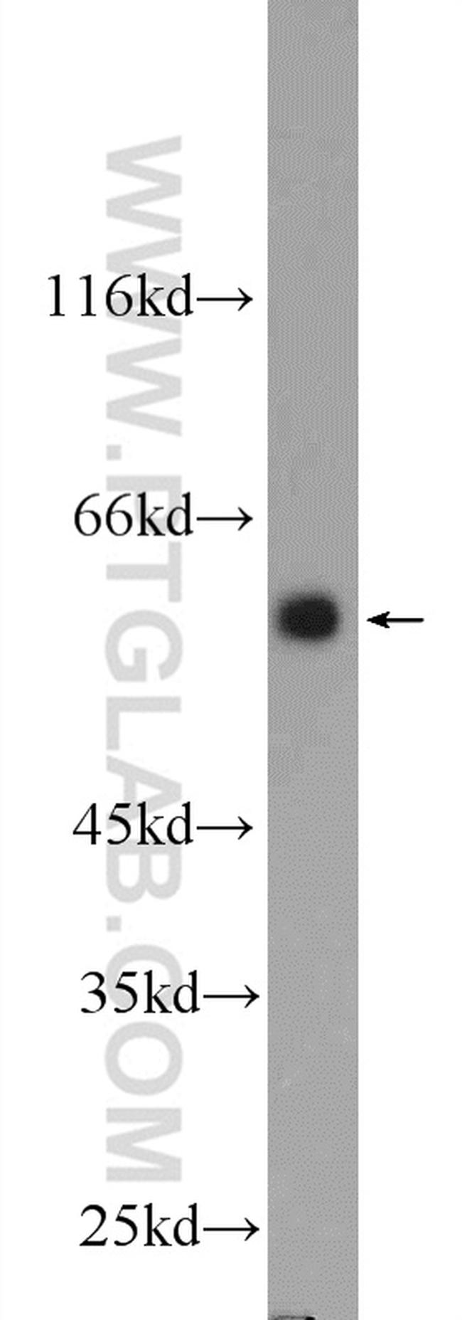 DYNC1LI1 Antibody in Western Blot (WB)