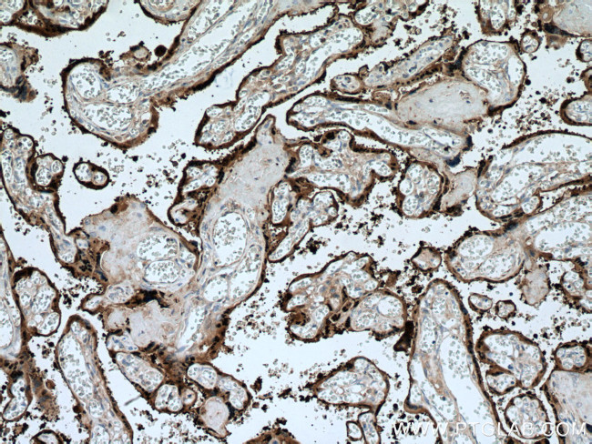 HSD17B1 Antibody in Immunohistochemistry (Paraffin) (IHC (P))