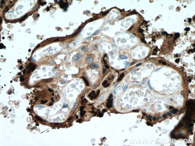 HSD17B1 Antibody in Immunohistochemistry (Paraffin) (IHC (P))