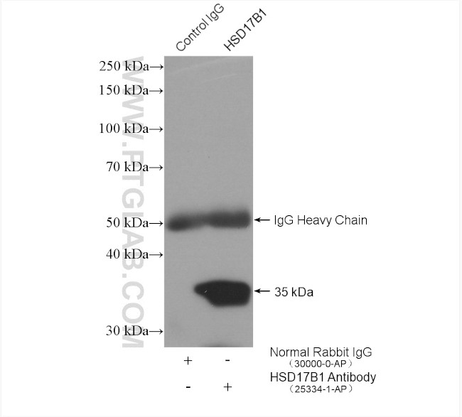 HSD17B1 Antibody in Immunoprecipitation (IP)