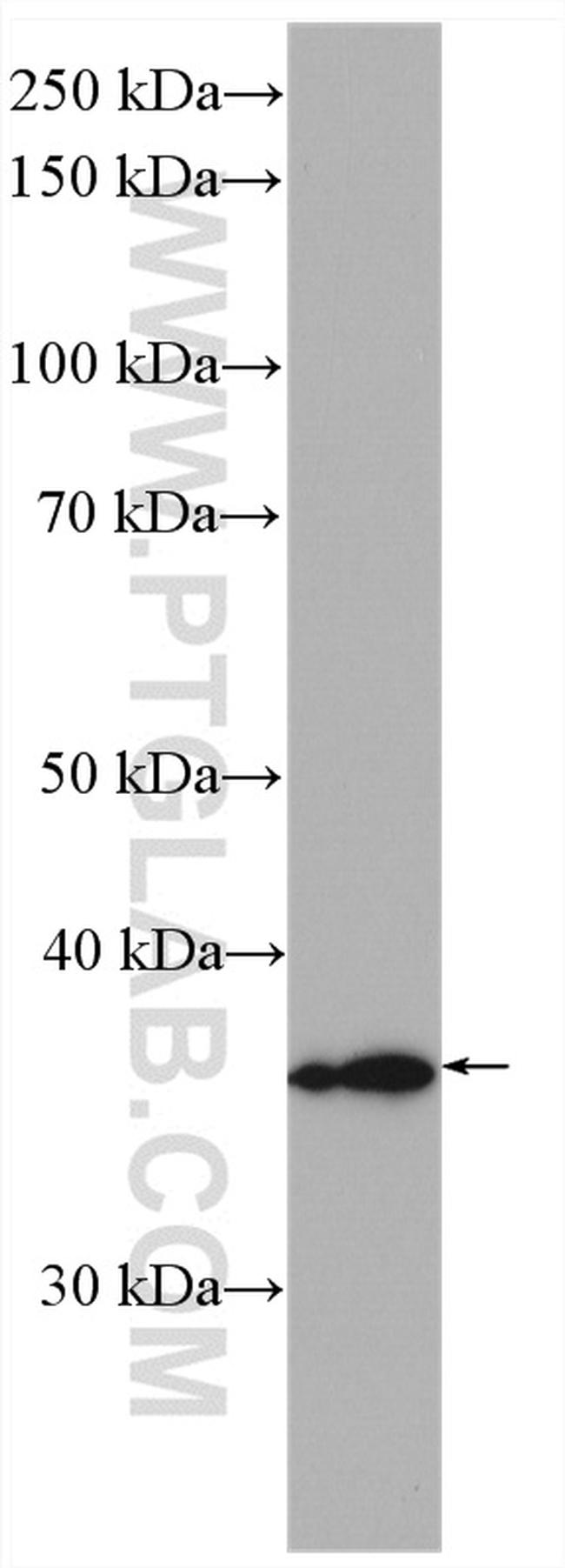 HSD17B1 Antibody in Western Blot (WB)