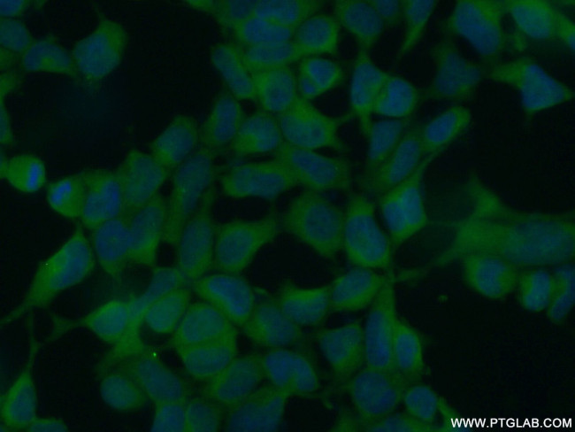 CHD3 Antibody in Immunocytochemistry (ICC/IF)