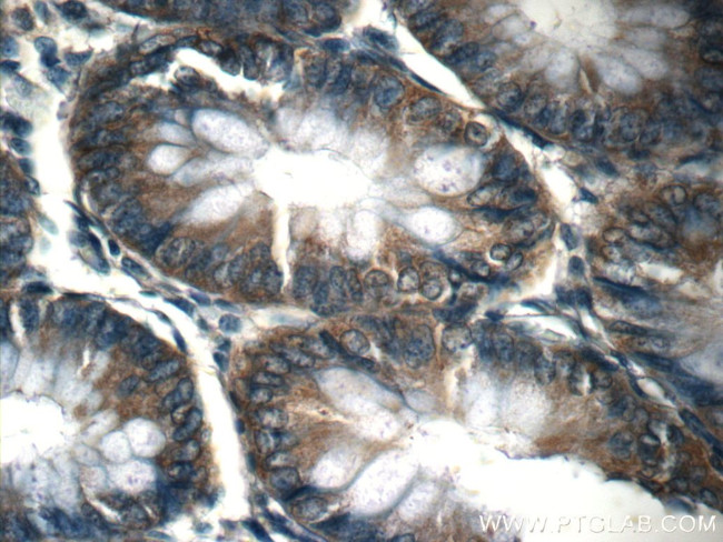 CHD3 Antibody in Immunohistochemistry (Paraffin) (IHC (P))