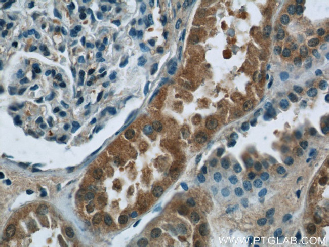 CHD3 Antibody in Immunohistochemistry (Paraffin) (IHC (P))