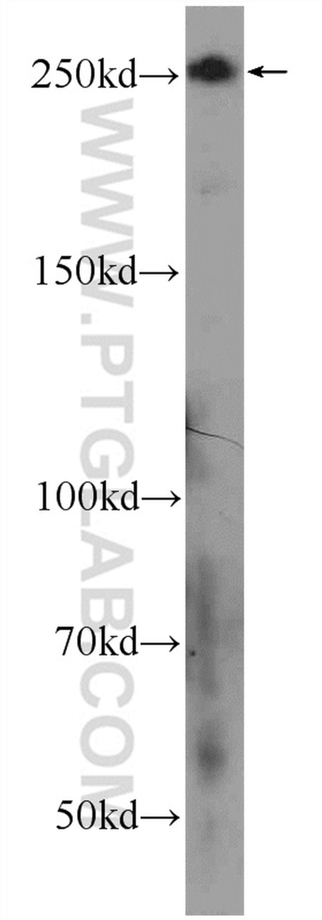 CHD3 Antibody in Western Blot (WB)