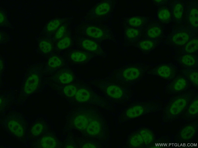 RTEL1 Antibody in Immunocytochemistry (ICC/IF)