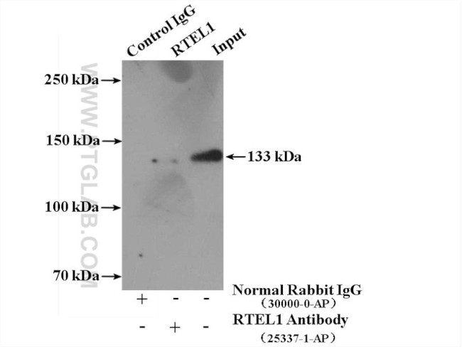 RTEL1 Antibody in Immunoprecipitation (IP)