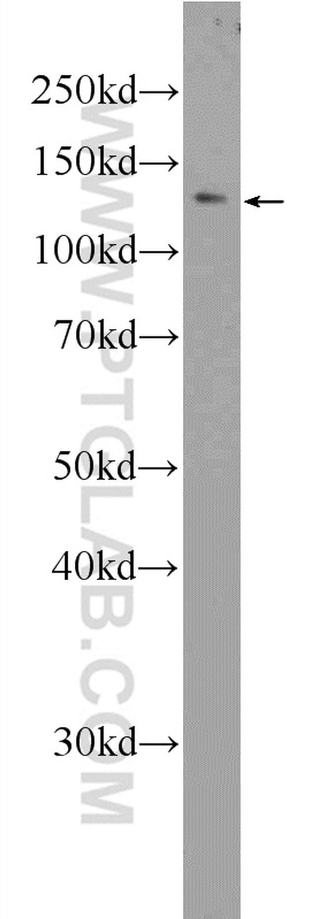 RTEL1 Antibody in Western Blot (WB)