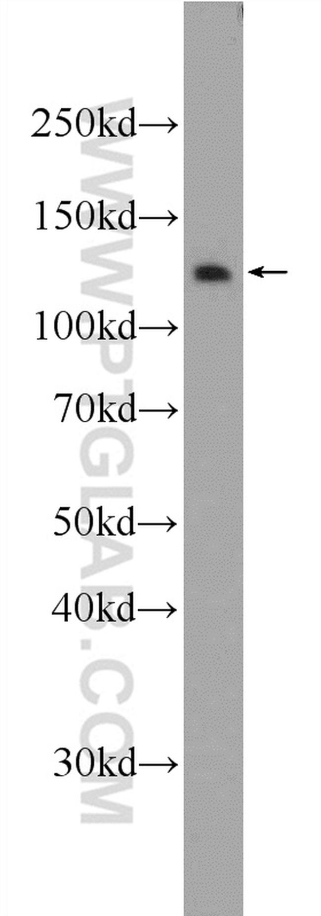 RTEL1 Antibody in Western Blot (WB)