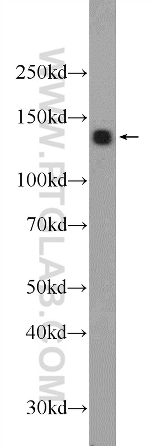 RTEL1 Antibody in Western Blot (WB)