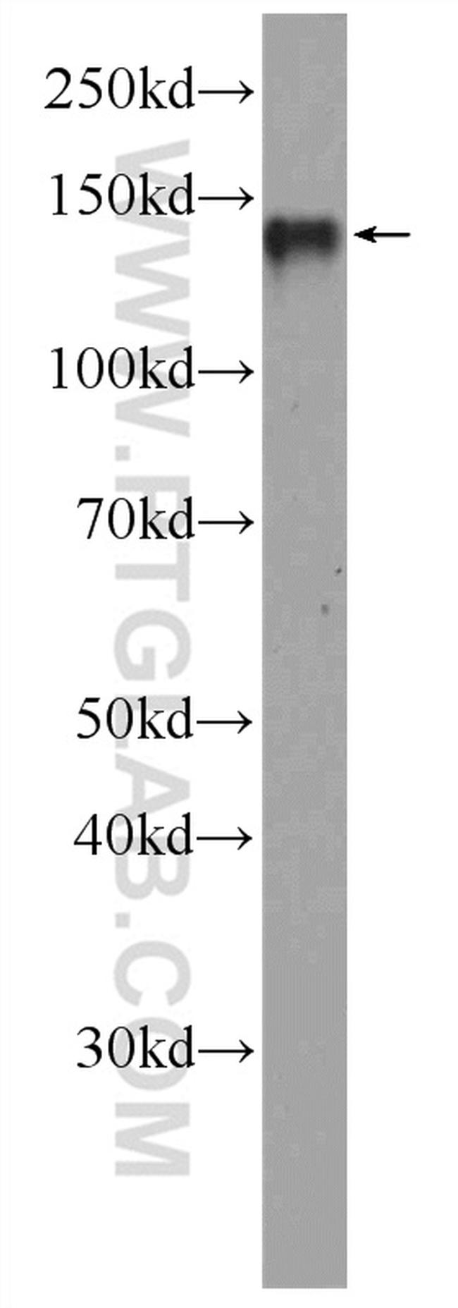 RTEL1 Antibody in Western Blot (WB)