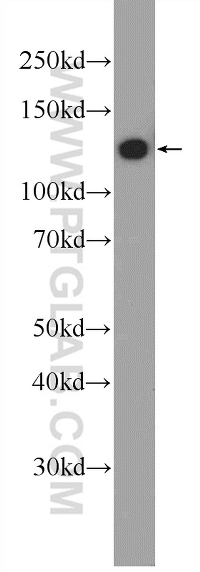 RTEL1 Antibody in Western Blot (WB)