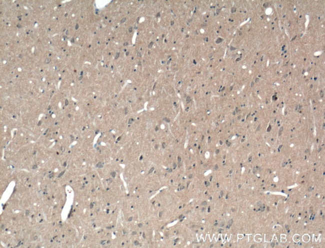 ABCA7 Antibody in Immunohistochemistry (Paraffin) (IHC (P))