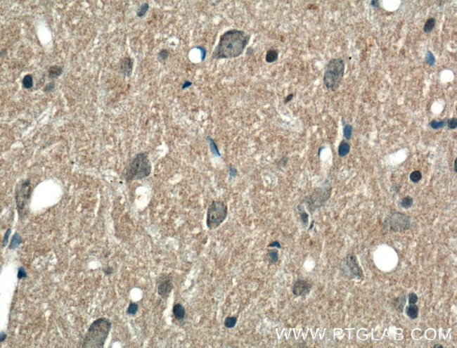 ABCA7 Antibody in Immunohistochemistry (Paraffin) (IHC (P))