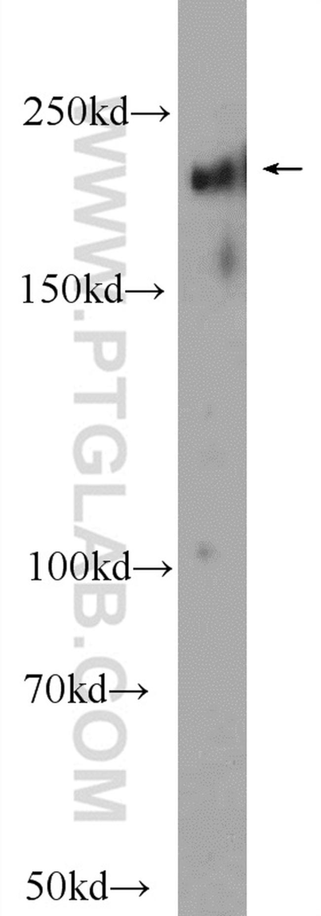 ABCA7 Antibody in Western Blot (WB)