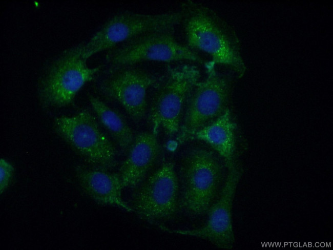 CPEB4 Antibody in Immunocytochemistry (ICC/IF)