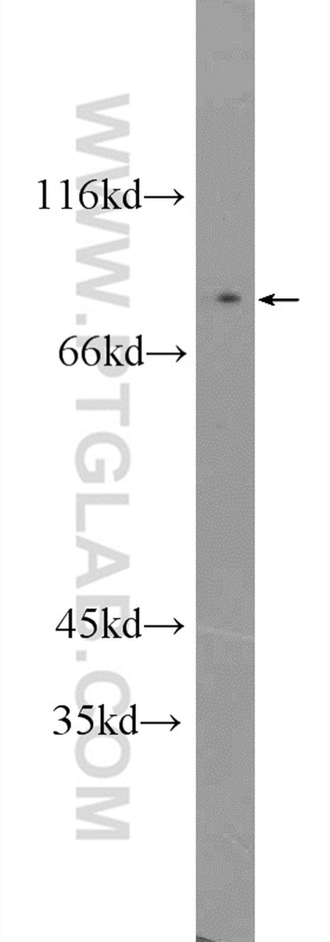 CPEB4 Antibody in Western Blot (WB)