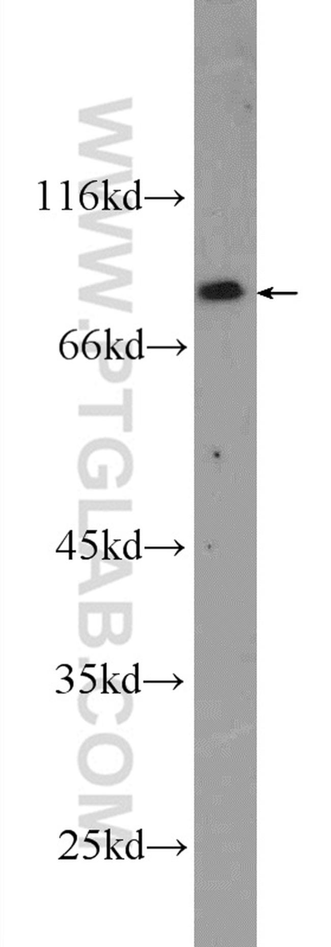 CPEB4 Antibody in Western Blot (WB)