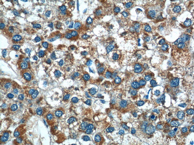 AGTR1 Antibody in Immunohistochemistry (Paraffin) (IHC (P))