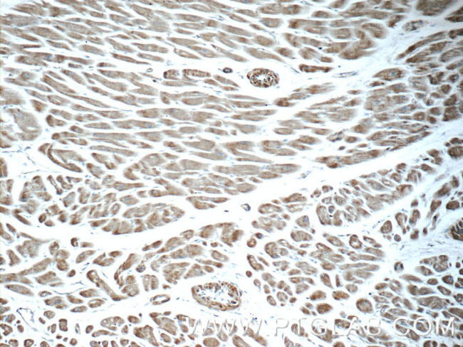 AGTR1 Antibody in Immunohistochemistry (Paraffin) (IHC (P))