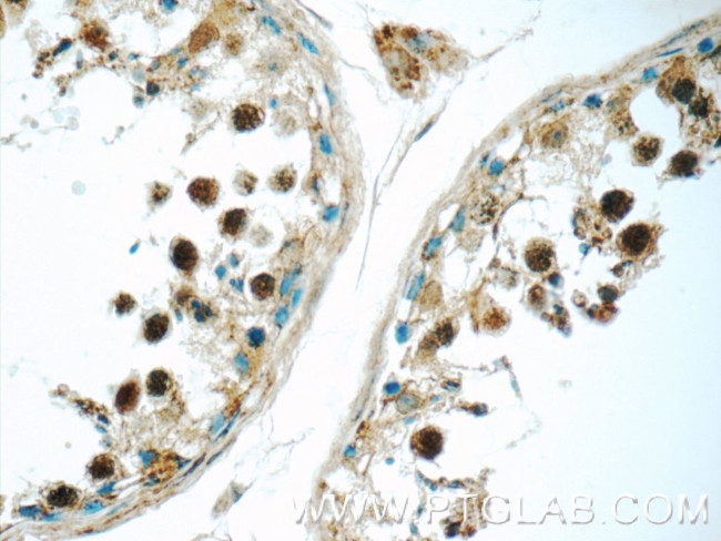 SENP1 Antibody in Immunohistochemistry (Paraffin) (IHC (P))