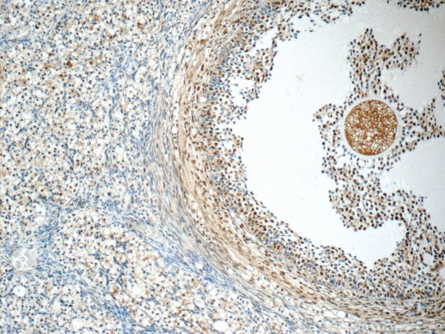 SENP1 Antibody in Immunohistochemistry (Paraffin) (IHC (P))